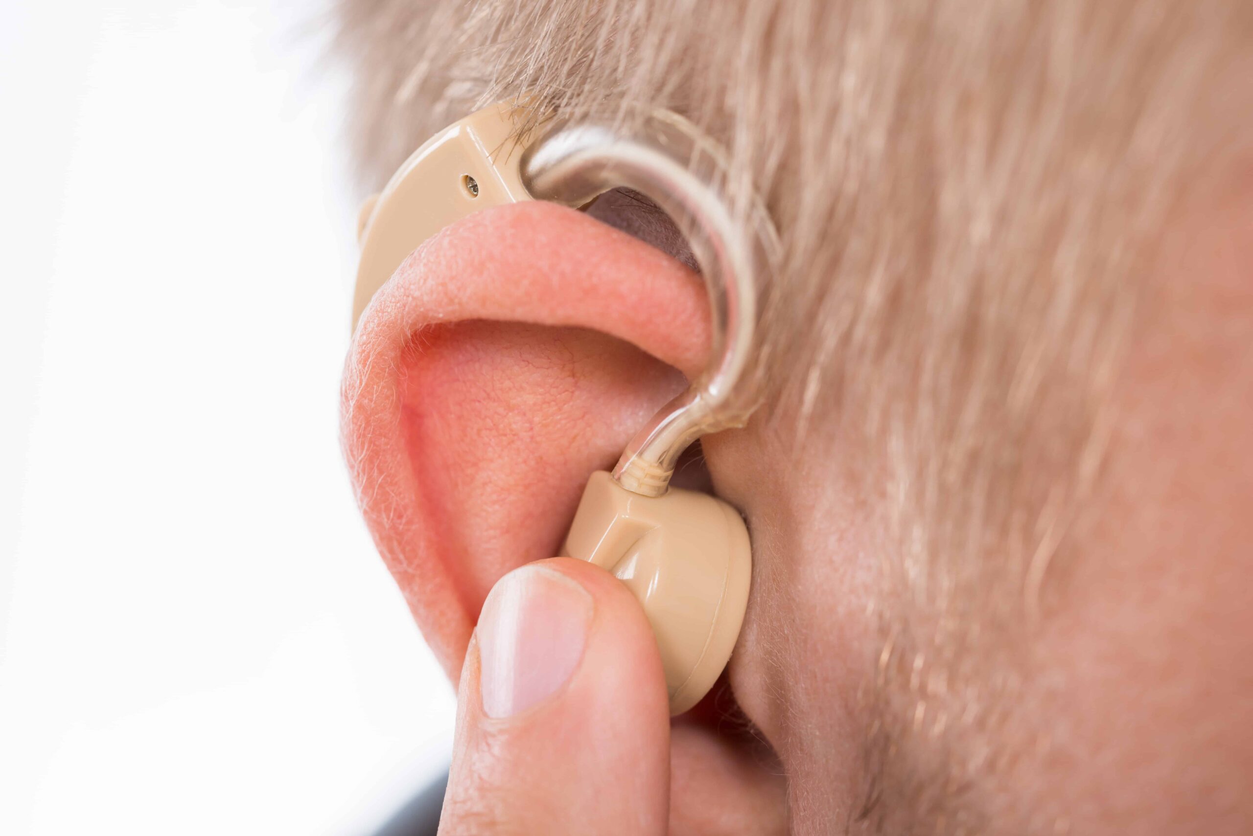 Hearing Loss VA Rating