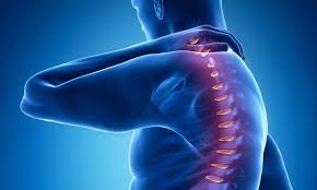 back pain with Intervertebral Disc Syndrome